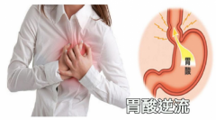 呼和浩特东大肛肠医院提醒您 经常胃反酸别忽视，当心诱发这些消化系统疾病