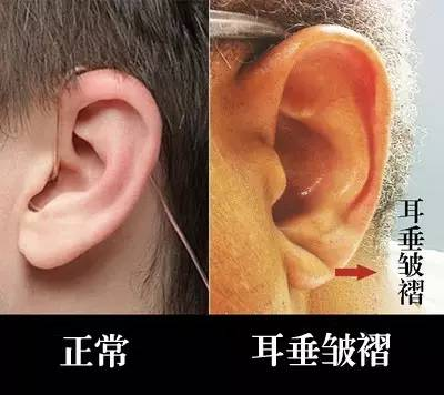 谢连娣wps5.png